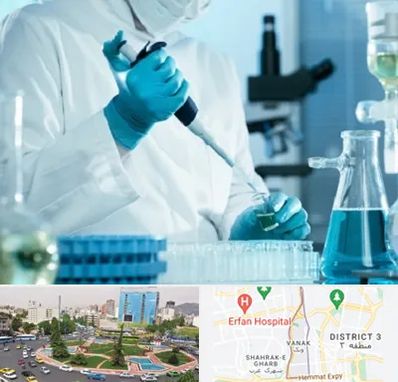 آزمایشگاه HIV در ونک 