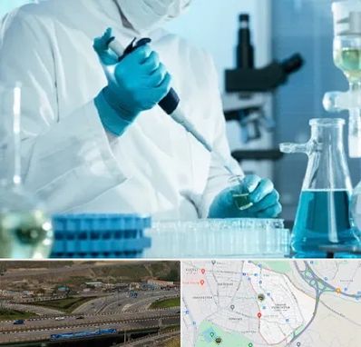 آزمایشگاه HIV در یاغچیان تبریز