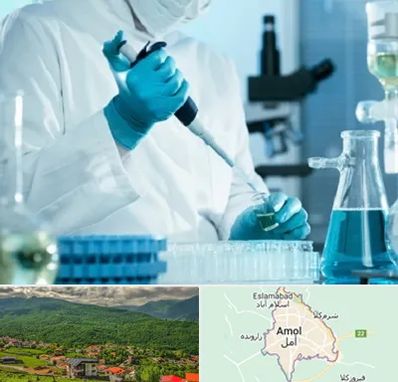 آزمایشگاه HIV در آمل