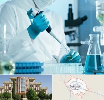 آزمایشگاه HIV در دهدشت