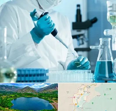 آزمایشگاه HIV در رودبار