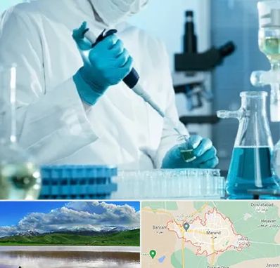 آزمایشگاه HIV در مرند