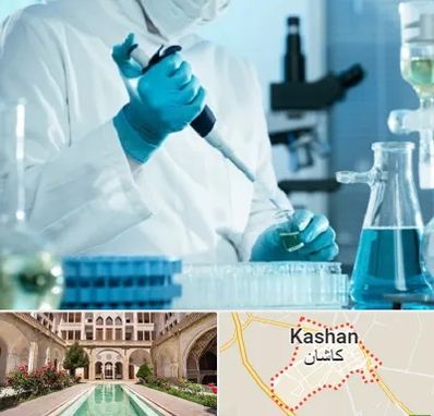 آزمایشگاه HIV در کاشان