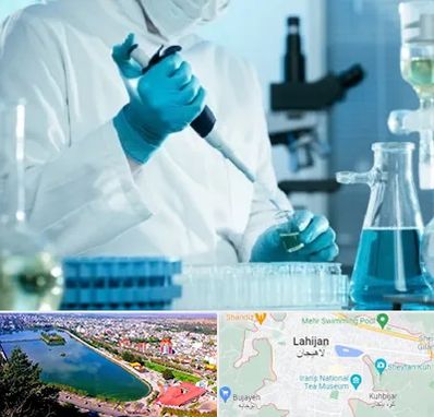 آزمایشگاه HIV در لاهیجان