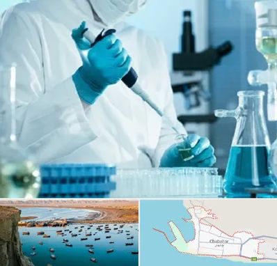 آزمایشگاه HIV در چابهار