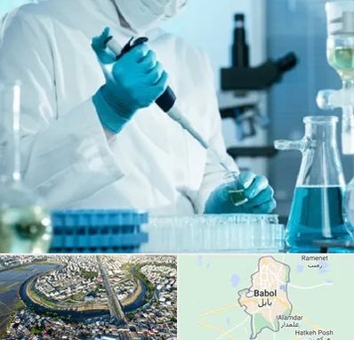 آزمایشگاه HIV در بابل