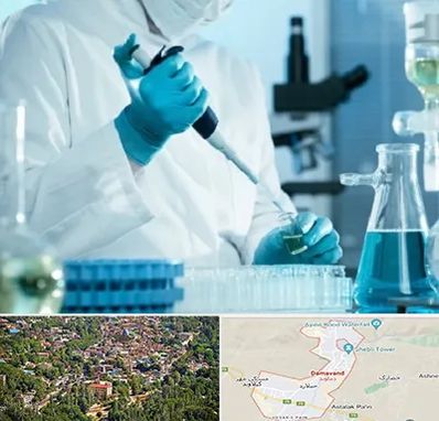 آزمایشگاه HIV در دماوند