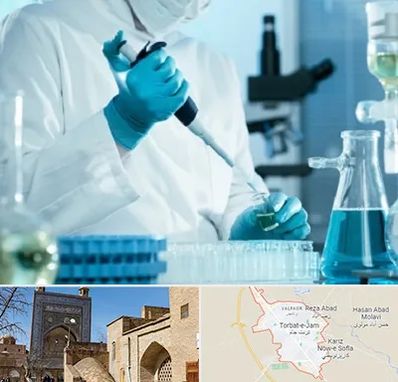 آزمایشگاه HIV در تربت جام