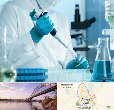 آزمایشگاه HIV در اهواز