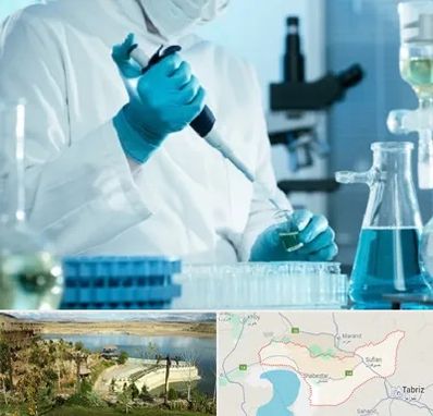 آزمایشگاه HIV در شبستر