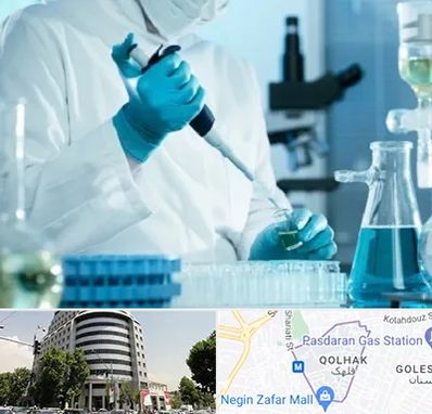 آزمایشگاه HIV در قلهک 