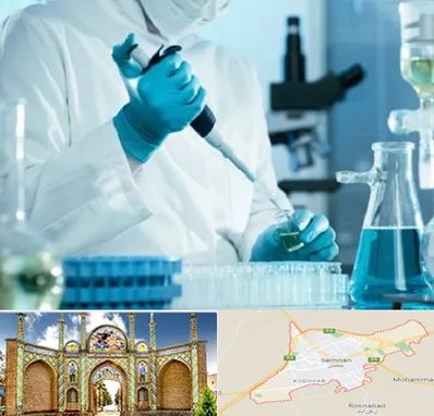 آزمایشگاه HIV در سمنان
