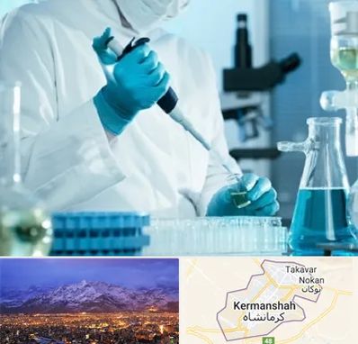 آزمایشگاه HIV در کرمانشاه