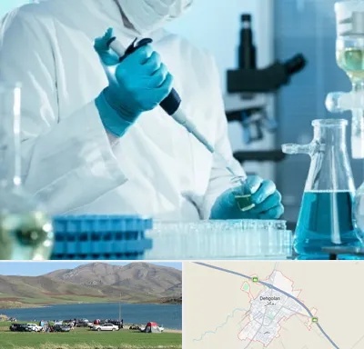 آزمایشگاه HIV در دهگلان
