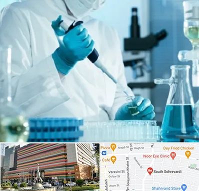 آزمایشگاه HIV در سهروردی 