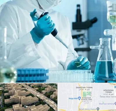 آزمایشگاه HIV در اکباتان 