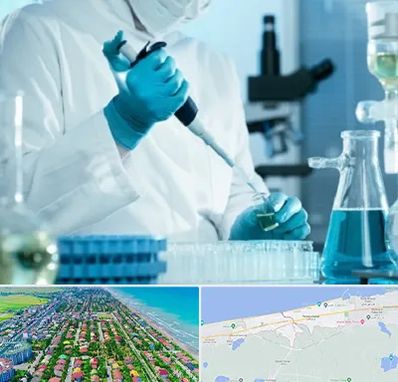 آزمایشگاه HIV در فریدونکنار