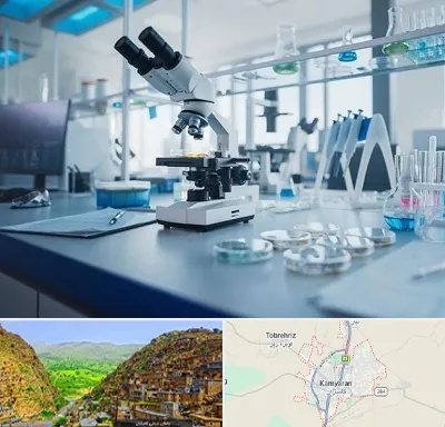 آزمایشگاه زگیل تناسلی در کامیاران