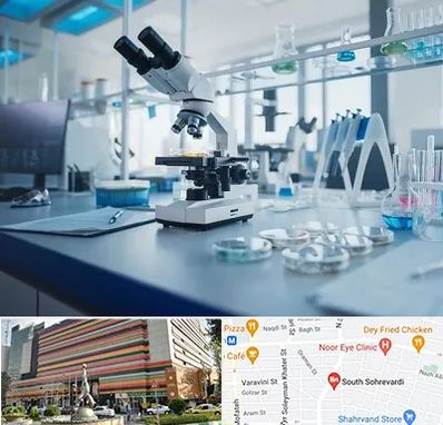 آزمایشگاه زگیل تناسلی در سهروردی 