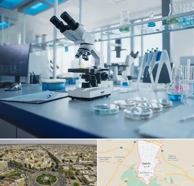 آزمایشگاه زگیل تناسلی در قزوین