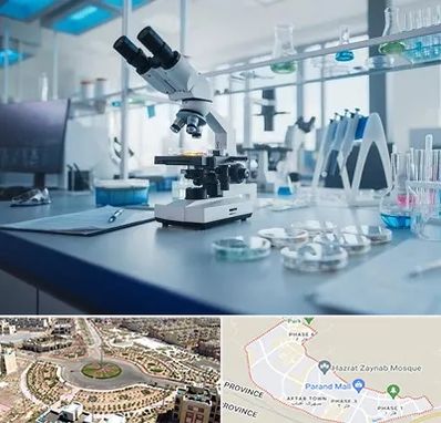 آزمایشگاه زگیل تناسلی در پرند