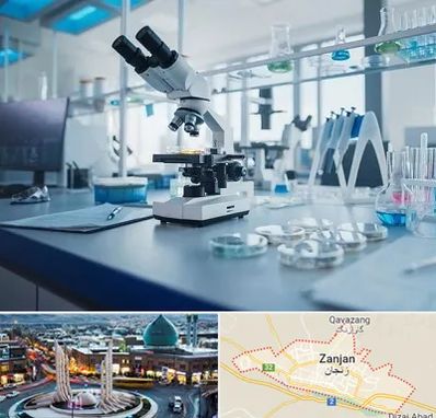 آزمایشگاه زگیل تناسلی در زنجان