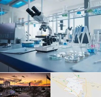 آزمایشگاه زگیل تناسلی در قوچان