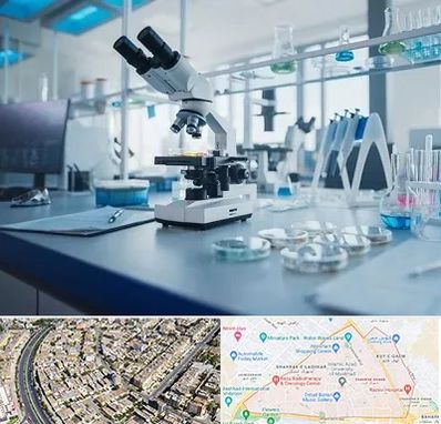 آزمایشگاه زگیل تناسلی در شهرک غرب مشهد