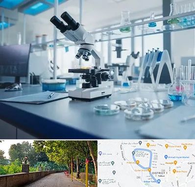 آزمایشگاه زگیل تناسلی در فلکه گاز رشت