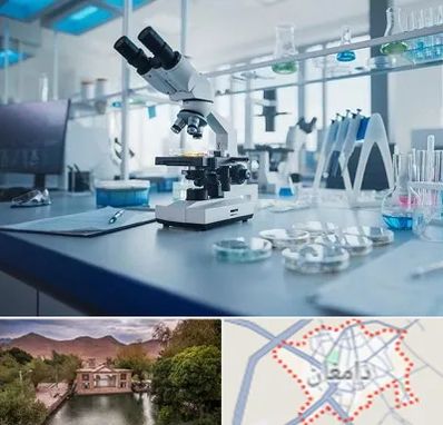 آزمایشگاه زگیل تناسلی در دامغان