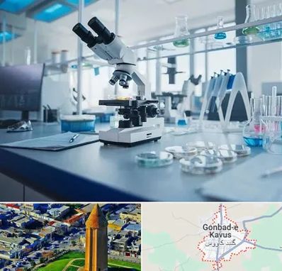 آزمایشگاه زگیل تناسلی در گنبد کاووس