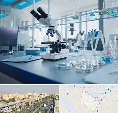 آزمایشگاه زگیل تناسلی در کیانمهر کرج