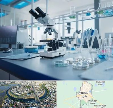 آزمایشگاه زگیل تناسلی در بابل