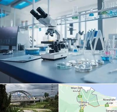 آزمایشگاه زگیل تناسلی در چالوس