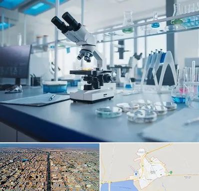 آزمایشگاه زگیل تناسلی در بندر ماهشهر