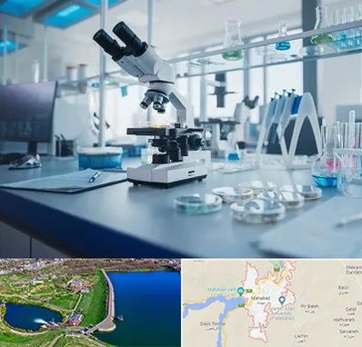 آزمایشگاه زگیل تناسلی در مهاباد