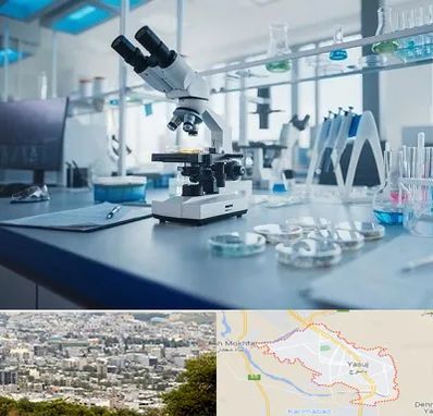 آزمایشگاه زگیل تناسلی در یاسوج