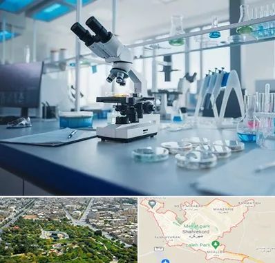 آزمایشگاه زگیل تناسلی در شهرکرد