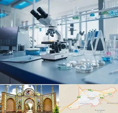 آزمایشگاه زگیل تناسلی در سمنان
