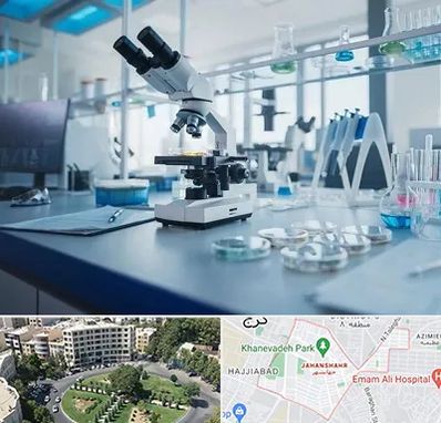 آزمایشگاه زگیل تناسلی در جهانشهر کرج 