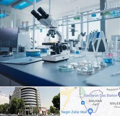 آزمایشگاه زگیل تناسلی در قلهک 