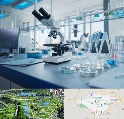 آزمایشگاه زگیل تناسلی در بجنورد