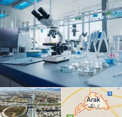آزمایشگاه زگیل تناسلی در اراک