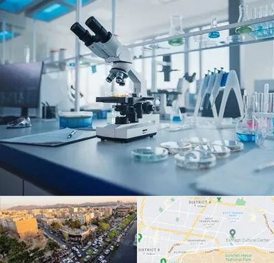 آزمایشگاه زگیل تناسلی در تهرانپارس 