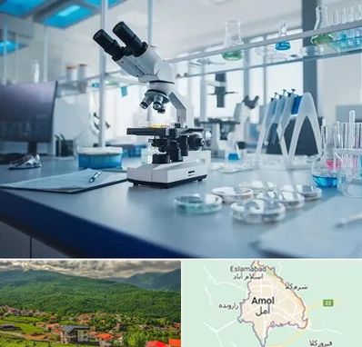 آزمایشگاه زگیل تناسلی در آمل