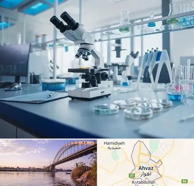 آزمایشگاه زگیل تناسلی در اهواز