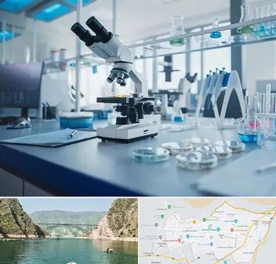 آزمایشگاه زگیل تناسلی در ایلام