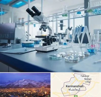 آزمایشگاه زگیل تناسلی در کرمانشاه