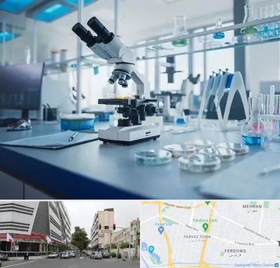 آزمایشگاه زگیل تناسلی در بلوار فردوس 
