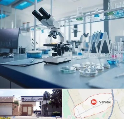 آزمایشگاه زگیل تناسلی در وحیدیه شهریار